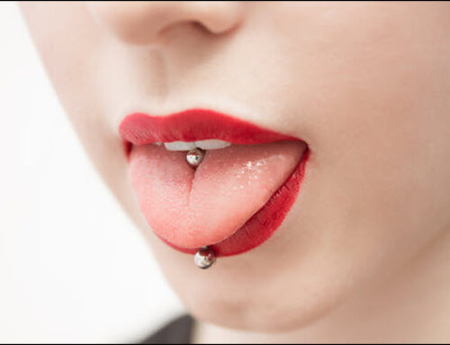 Lip and Tongue Piercings: Oral Hygiene Risks