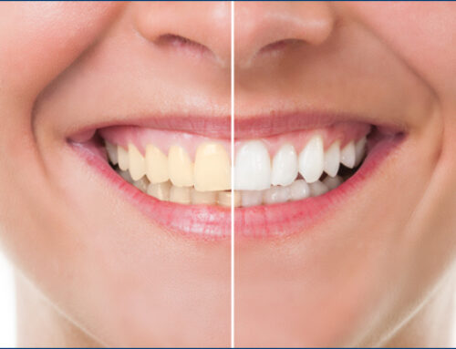 Smile Enhancement: Effective Treatments for a Brighter, Healthier Grin