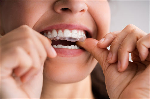 Bruxism