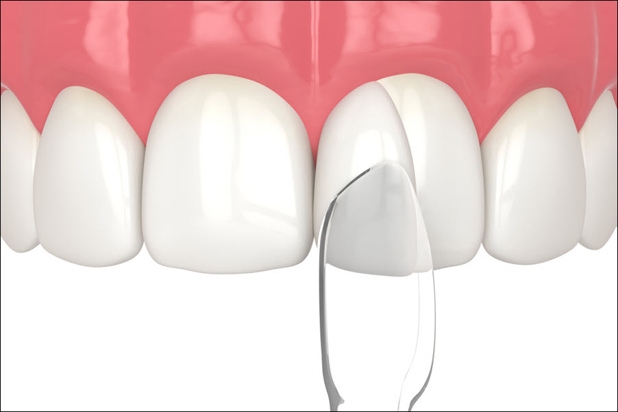 Damaged Teeth