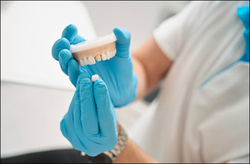 Dental Crowns