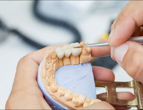 Smile Restoration: Dental Crowns and Bridges