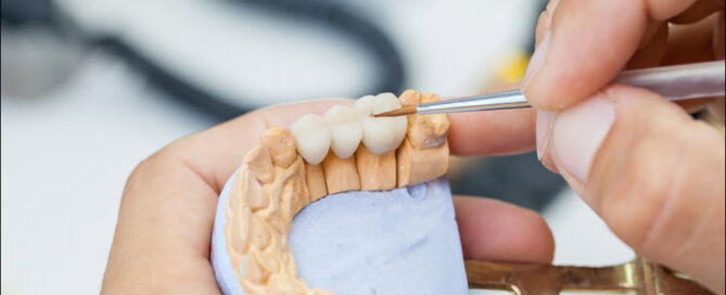 Dental Crowns