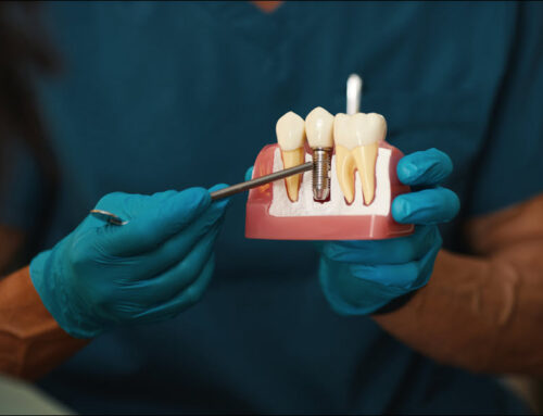 Dental Implants as a Restorative Option