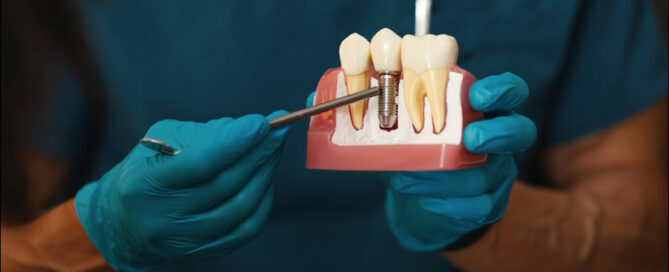 Dental Implants