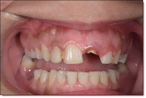 Restorative Dentistry