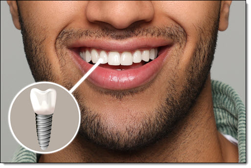 Restorative Dentistry