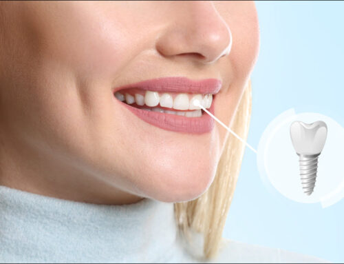 Restorative Dentistry for Accident-Related Tooth Loss