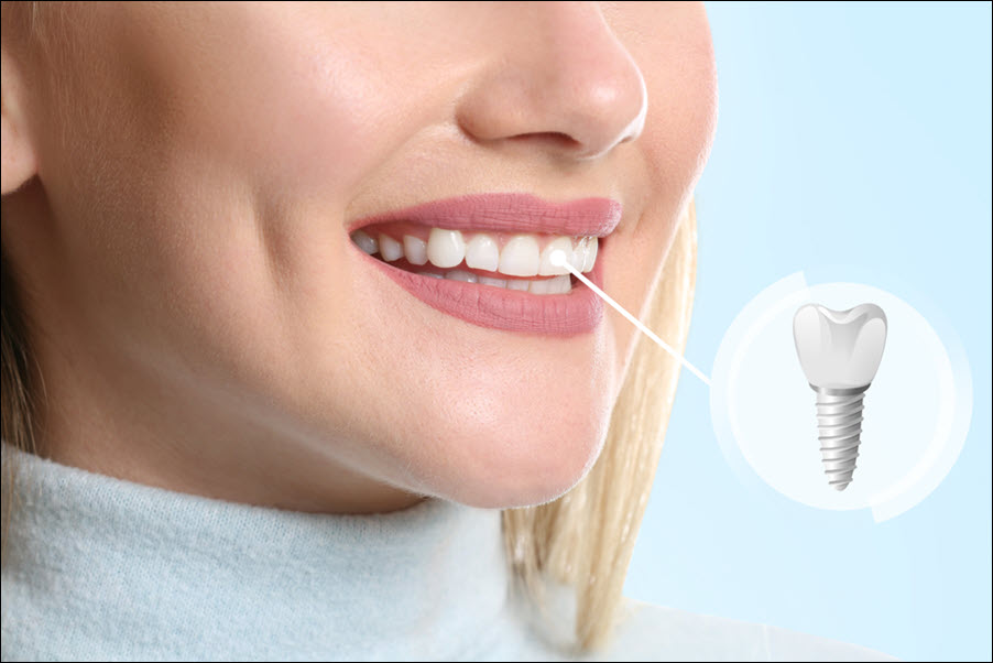 Restorative Dentistry