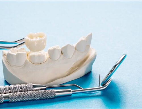 Restore Your Smile with Dental Crowns